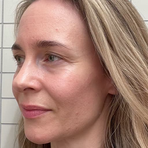 Bilde av Charlotte etter at hun har tatt The Solution